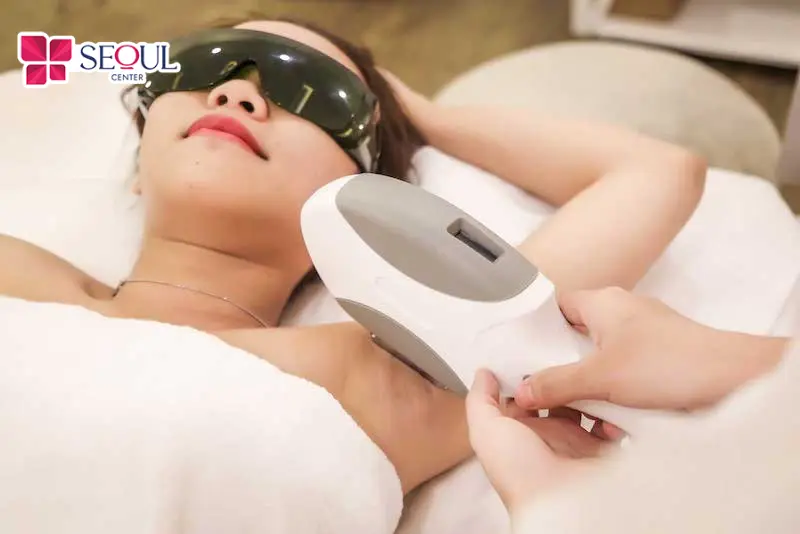 Công nghệ triệt lông hiện đại giúp lông mọc thưa, mảnh hơn, đồng thời cải thiện vùng da dưới cánh tay sáng mịn và đều màu.