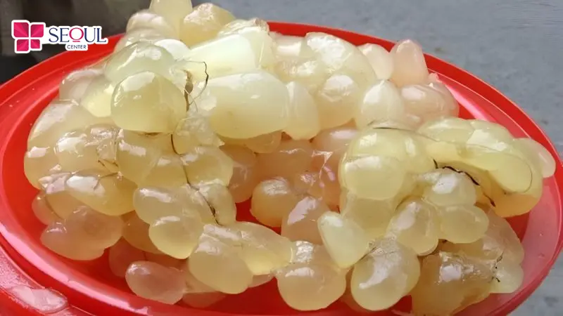 Thoa một lớp mỡ trăn mỏng lên vùng da dưới cánh tay sau khi loại bỏ lông để hỗ trợ làm lông mọc chậm và thưa hơn.