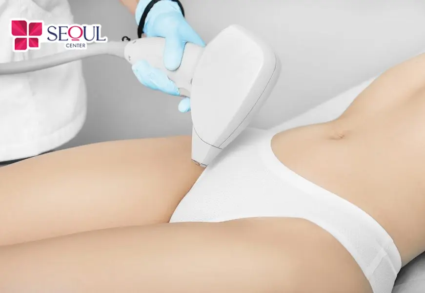 Triệt lông bikini mang lại nhiều lợi ích nên ngày càng được phụ nữ quan tâm, áp dụng