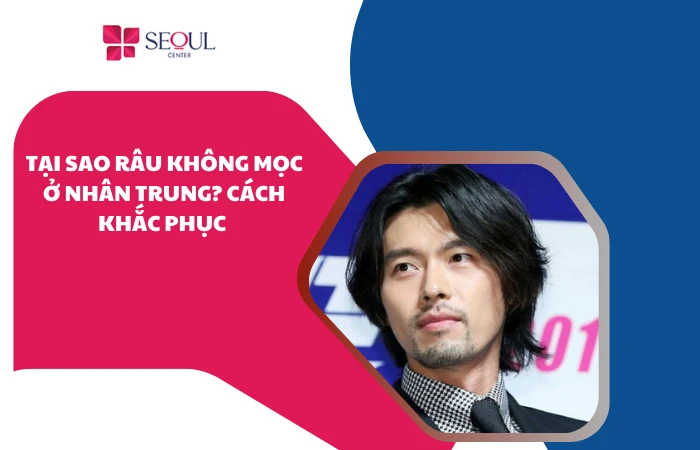 Tại sao râu không mọc ở nhân trung? Cách khắc phục hiệu quả
