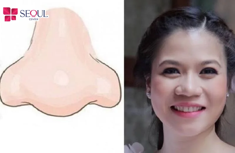 Theo nhân tướng học, phụ nữ mũi to thường được cho là mạnh mẽ, tự lập, biết quản lý tài chính nhưng đường tình duyên có thể gặp nhiều trắc trở.