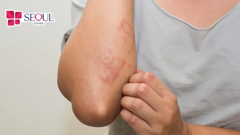 Thực hiện sai kỹ thuật hoặc quy trình không đảm bảo có thể khiến vùng da điều trị xuất hiện tình trạng mẩn đỏ và kích ứng nhẹ.