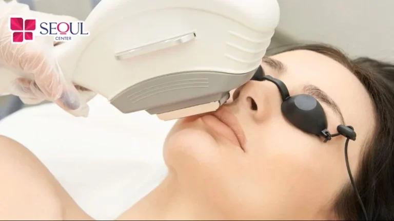 Đối tượng có làn da nhạy cảm lựa chọn công nghệ OPT để dọn sạch lông