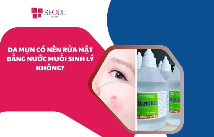 Da mụn có nên rửa mặt bằng nước muối sinh lý không