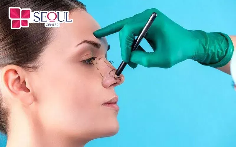 Nâng mũi chữ L phù hợp với những ai có khuôn mặt sắc nét, góc cạnh