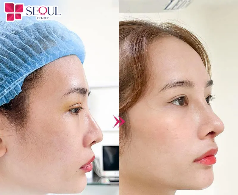 Khách hàng tin tưởng lựa chọn Seoul Center để cải thiện ngoại hình