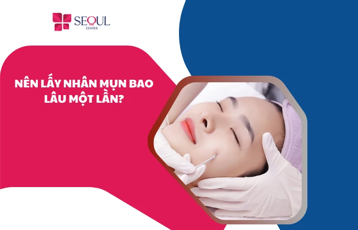 Nên lấy nhân mụn bao lâu một lần