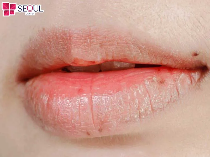Những người có màu môi bị phai nhạt hoặc loang lổ nên thực hiện dặm lại môi