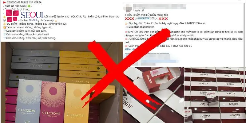 Kiểm tra tem nhãn và nguồn gốc filler trước khi tiêm là lưu ý quan trọng để đảm bảo an toàn