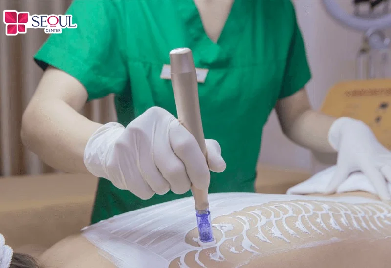 Lựa chọn buổi lẻ hoặc liệu trình trọn gói tùy mức độ mụn, giúp tối ưu chi phí và nâng cao hiệu quả điều trị.