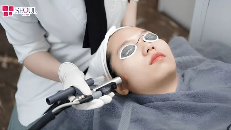 Chi phí trị thâm mụn bằng laser phụ thuộc vào công nghệ được áp dụng