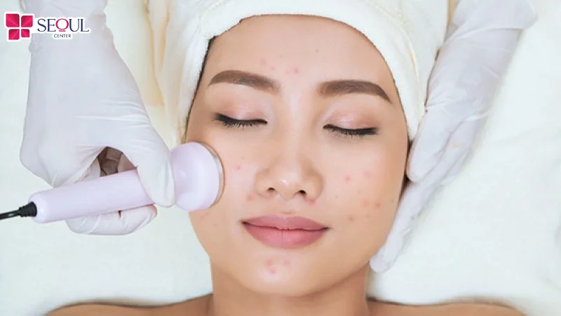 Điện di Vitamin C là phương pháp giảm thâm mụn an toàn và tiết kiệm