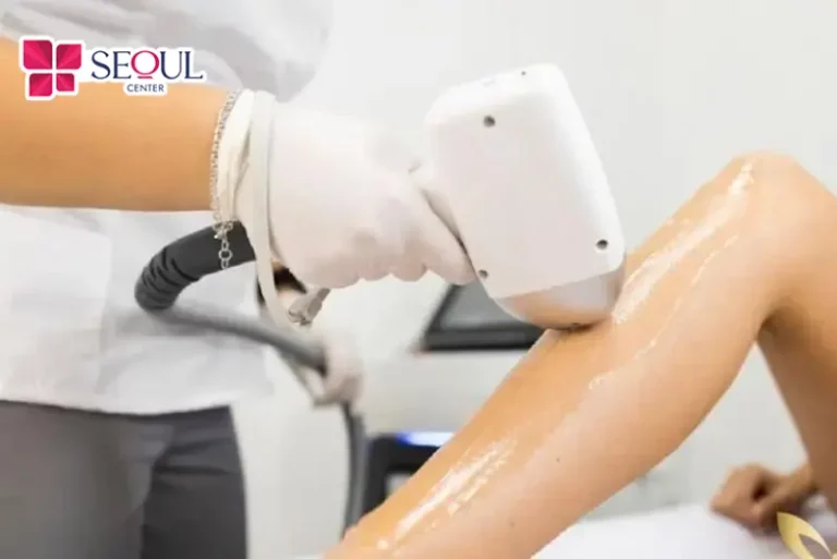 Thoa gel lạnh trước khi chiếu laser giúp giảm thiểu tối đa cảm giác đau rát trên da