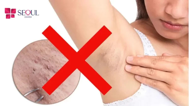 Hạn chế tẩy hoặc nhổ lông khoảng 2 tháng trước khi triệt để giữ nguyên nang lông, giúp công nghệ triệt tác động hiệu quả hơn.