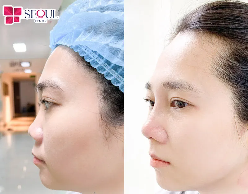 Ngày nay sẽ không còn quá khó khăn để giúp bạn sở hữu một chiếc mũi tài lộc