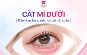Cắt Mí Dưới: Giải Pháp Loại Bỏ Bọng Mỡ, Da Dư & Trẻ Hóa Vùng Mắt