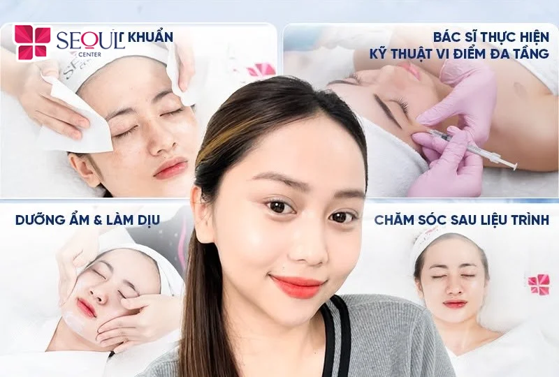 Quy trình thực hiện tiêm B.A.P Karisma – RH Collagen được bác sĩ chuyên khoa thực hiện theo tiêu chuẩn y khoa