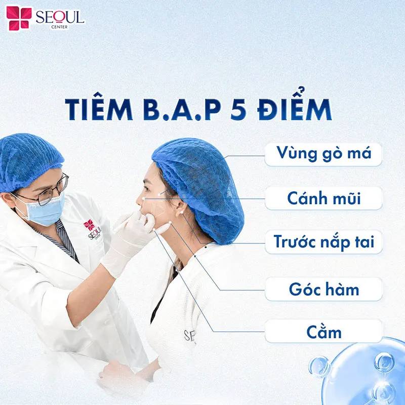 Bác sĩ tiến hành xác định 5 điểm trước khi tiêm B.A.P Xcelen Genyal vào da cho khách hàng theo quy trình chuẩn an toàn y khoa