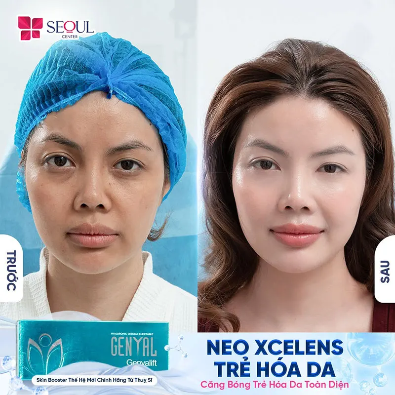 Làn da khô ráp, xỉn màu, kém tươi tắn của chị khách đã được “lột xác” trở thành làn da căng mướt, mượt mà, mịn màng và tươi tắn