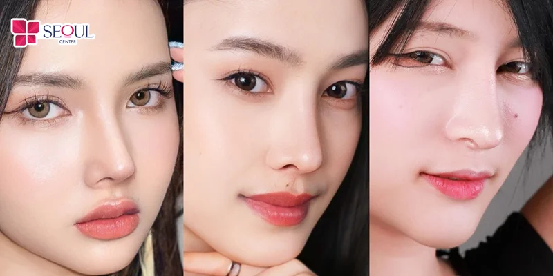 Nâng mũi sụn tai phù hợp với nhiều trường hợp muốn cải thiện dáng mũi tự nhiên, cân đối và hài hòa với khuôn mặt.