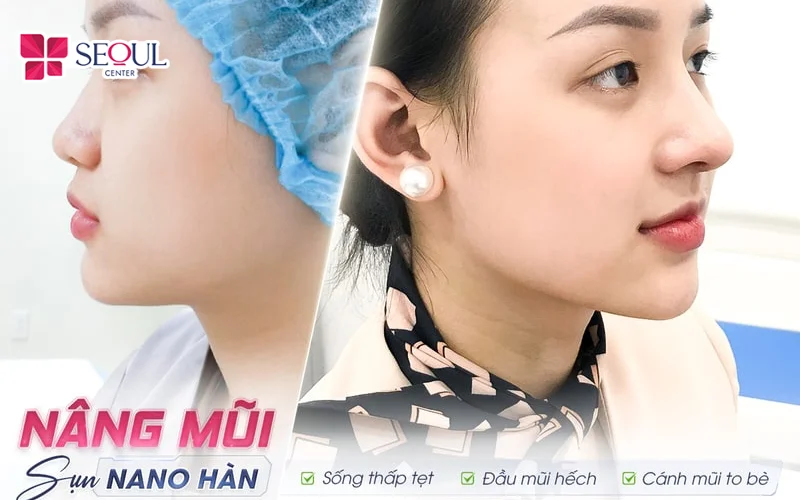 Dáng mũi cao thanh thoát, tự nhiên và hài hoà với gương mặt