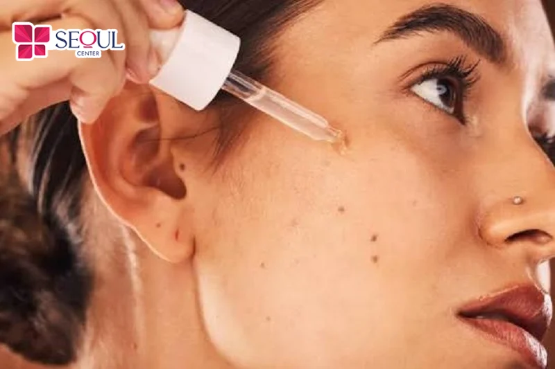 Thoa serum đặc trị mụn lên vùng da có mụn sẽ giúp các nốt mụn nhanh gom cồi, giảm sưng viêm, giảm tiết nhờn