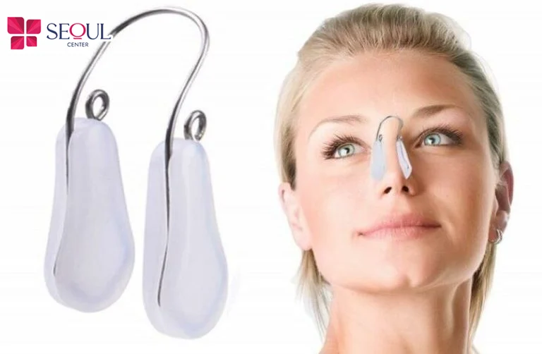 Dùng kẹp nâng mũi sau một thời gian sẽ cải thiện cánh mũi thon gọn