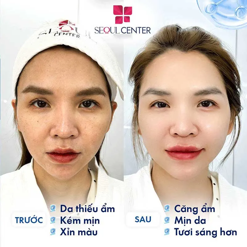 Dịch vụ chăm sóc da Luxury khắc phục làn da thiếu ẩm, kém mịn màng và xỉn màu khá tốt