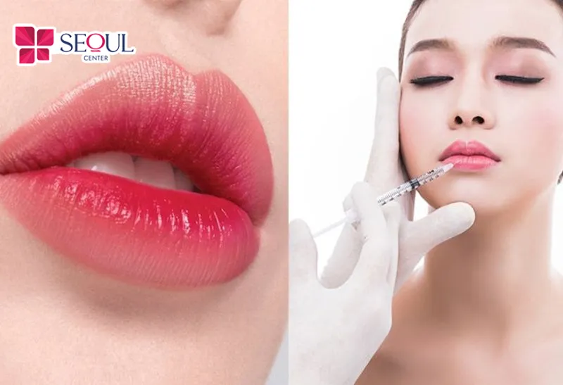 Dáng môi cười giúp gương mặt luôn tươi tắn và rạng rỡ tự nhiên
