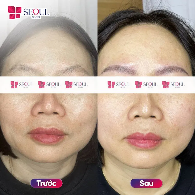 Chân mày sau điêu khắc 9D cho kết quả khá tự nhiên, hài hòa gương mặt