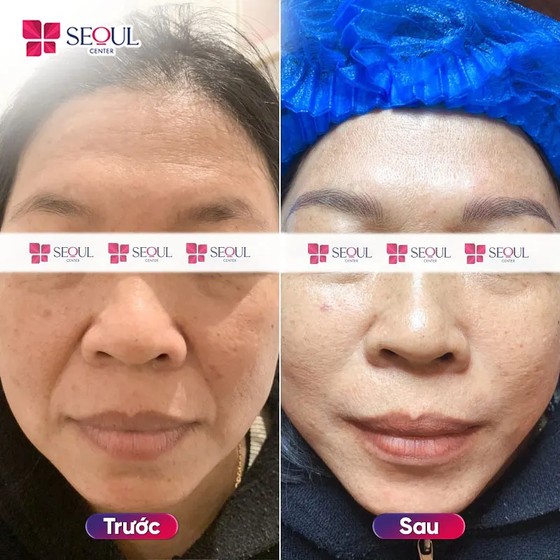 Điêu khắc chân mày 9D giúp khắc phục những khuyết điểm chân mày thưa, nhạt, mỏng, thiếu đầu đuôi