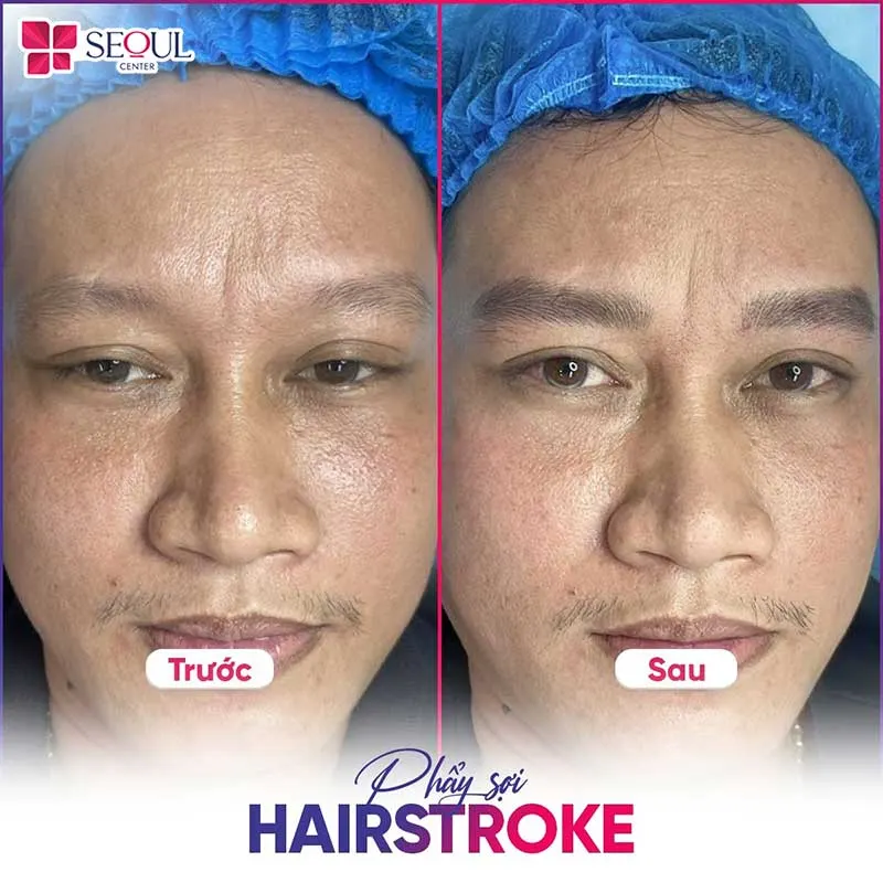 Dịch vụ phẩy sợi hairstroke giúp anh khách sở hữu ngay dáng mày sắc nét, cân đối, gương mặt nam tính hơn