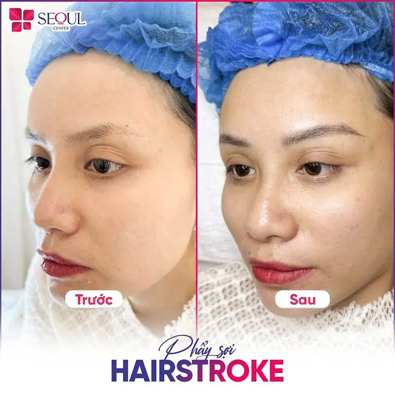 Sau khi sử dụng dịch vụ phẩy sợi hairstroke dáng mày cô gái rõ dáng hơn, sắc nét hơn nhưng đầy tự nhiên và hài hòa gương mặt