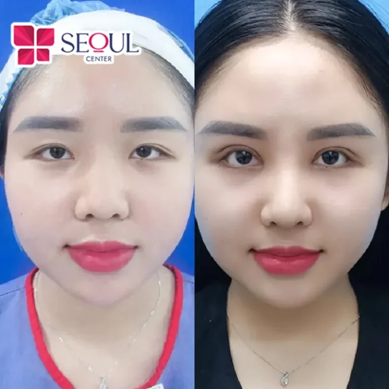 Mở Rộng Góc Mắt là dịch vụ sở hữu nhiều ưu điểm nổi bật giúp khách hàng ưu ái lựa chọn