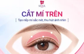 Cắt Mí Trên - Tròn đẹp, tự nhiên