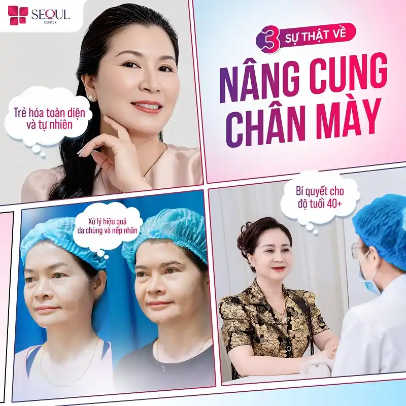 Nâng Cung Chân Mày sở hữu nhiều ưu điểm vượt trội như định hình dáng mày thanh tú, thời gian thực hiện nhanh, an toàn, ít xâm lấn