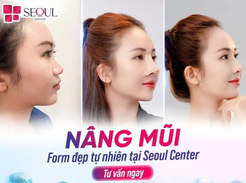 Nâng mũi tại Seoul Center bạn sẽ không phải lo lắng về rủi ro