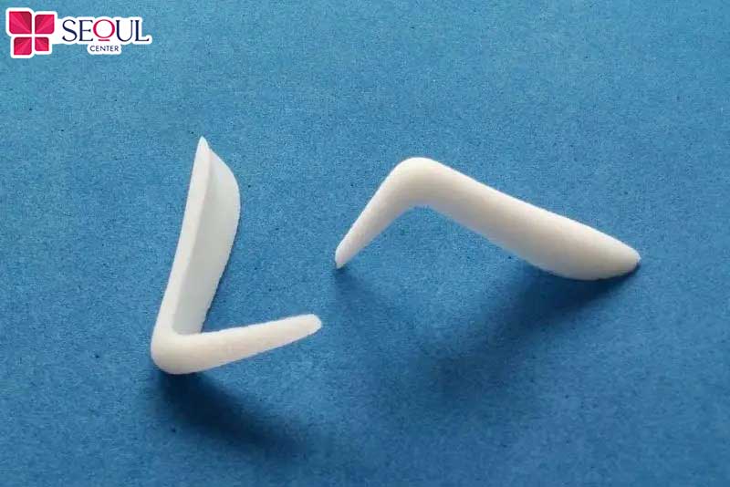 Sụn Surgiform bám với các tế bào sẽ tạo thành cấu trúc mũi vững chắc, duy trì độ bền cao
