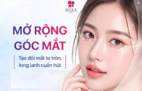 Mở Rộng Góc Mắt - Điều chỉnh góc mắt trong theo đặc điểm giải phẫu