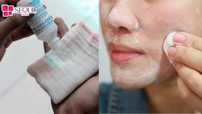 Oxy già tạo hiệu ứng sủi bọt giúp làm sạch bã nhờn và hỗ trợ diệt khuẩn mụn