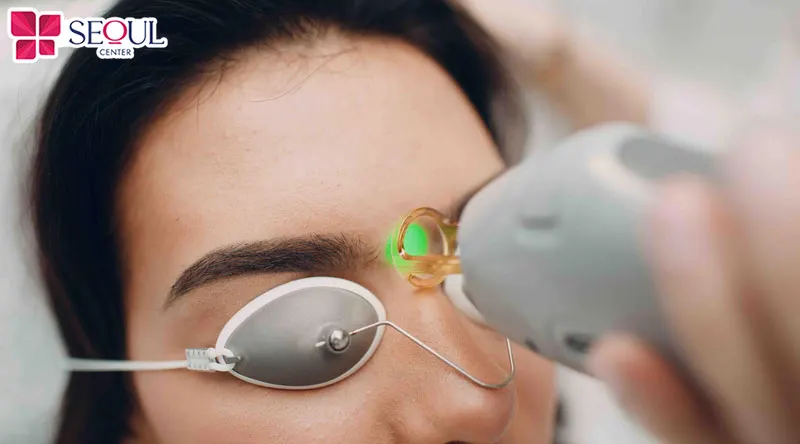 Xóa xăm mày bằng laser giúp phá vỡ sắc tố mực, hỗ trợ làm nhạt màu mày và tạo nền da phù hợp cho việc chỉnh sửa dáng mày mới