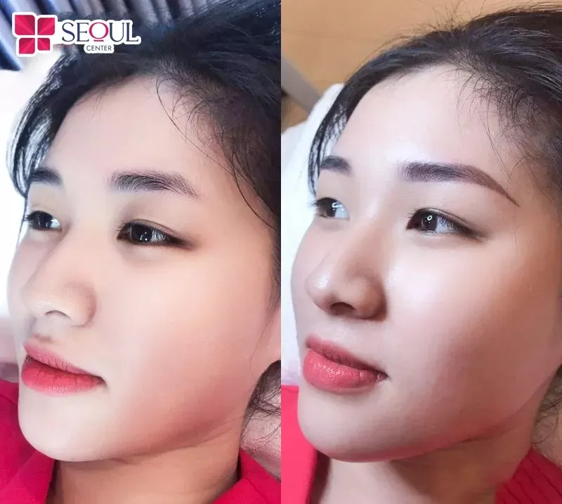Lựa chọn màu mực tươi sáng và dáng mày phù hợp giúp gương mặt trở nên trẻ trung