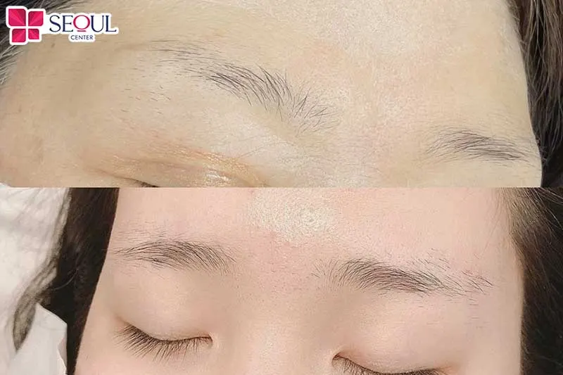 Những ai có dáng mày thưa, nhạt, đứt đoạn có thể lựa chọn phun mày Shading để tạo dáng mày mới tôn đường nét gương mặt