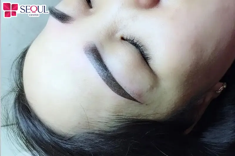 Xăm lông mày là phương pháp truyền thống sử dụng kim đâm sâu xuống tầng hạ bì của da