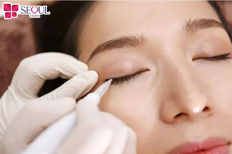 Bôi tê chuyên dụng trước khi làm giúp quá trình phun mí diễn ra êm ái không đau rát