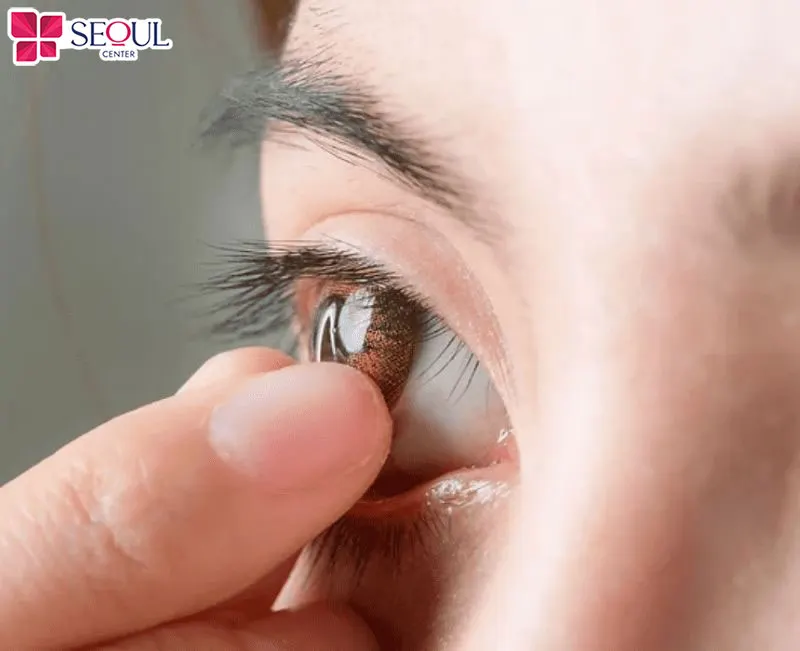 Tháo kính áp tròng và giữ mắt nghỉ ngơi giúp quá trình phun mí diễn ra thuận lợi