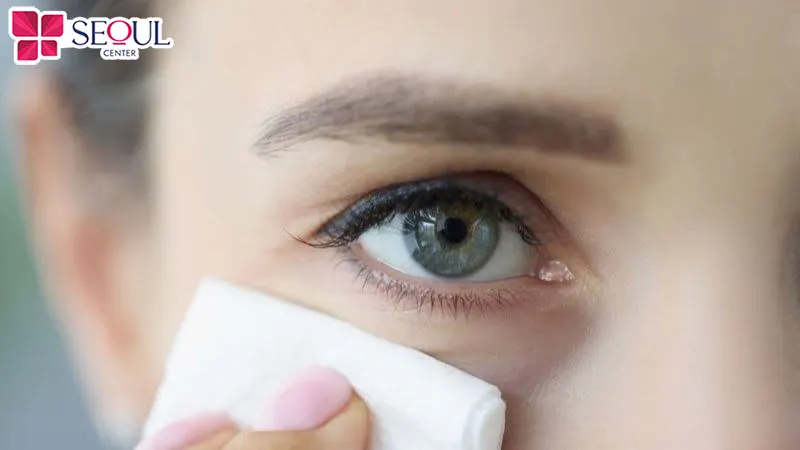 Vệ sinh mắt bằng nước muối sinh lý để hỗ trợ đường viền mí nhanh phục hồi