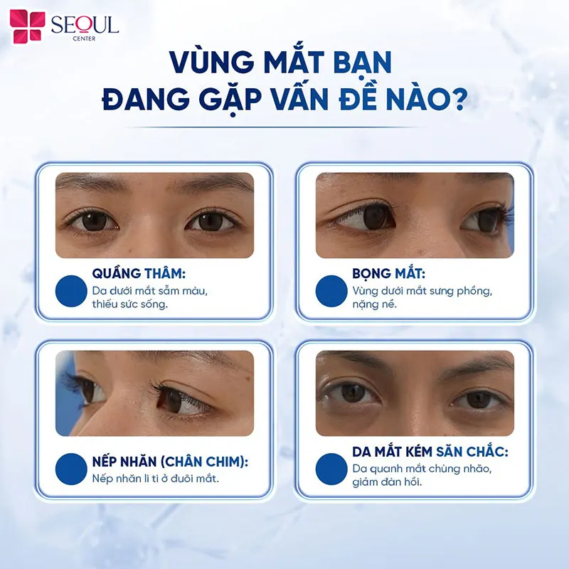 Những vấn đề vùng mắt phù hợp áp dụng dịch vụ Rejuran I – PN Xoá Thâm Mắt