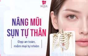 Nâng Mũi Sụn Tự Thân - Sử dụng mô sụn của chính khách hàng theo chỉ định