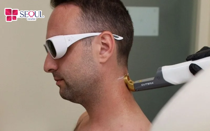 Trị thâm cổ Laser Fractional có thể để lại cảm giác châm chích nhẹ trên da trong quá trình thực hiện